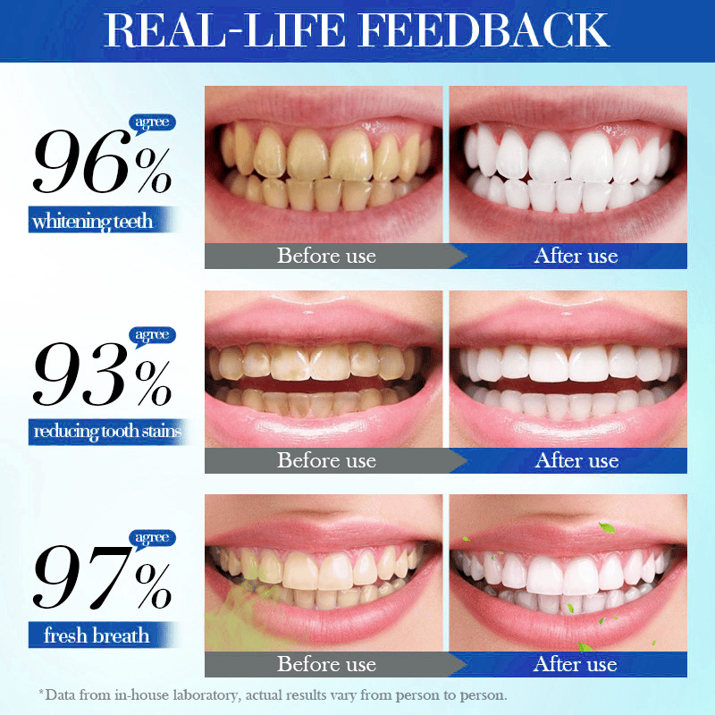 💥Hot Listing 🔥 AQA™ Hydroxyapatite Toothpaste 7.5% for Enamel Repair & Teeth Whitening Refreshing Flavor Fluorid