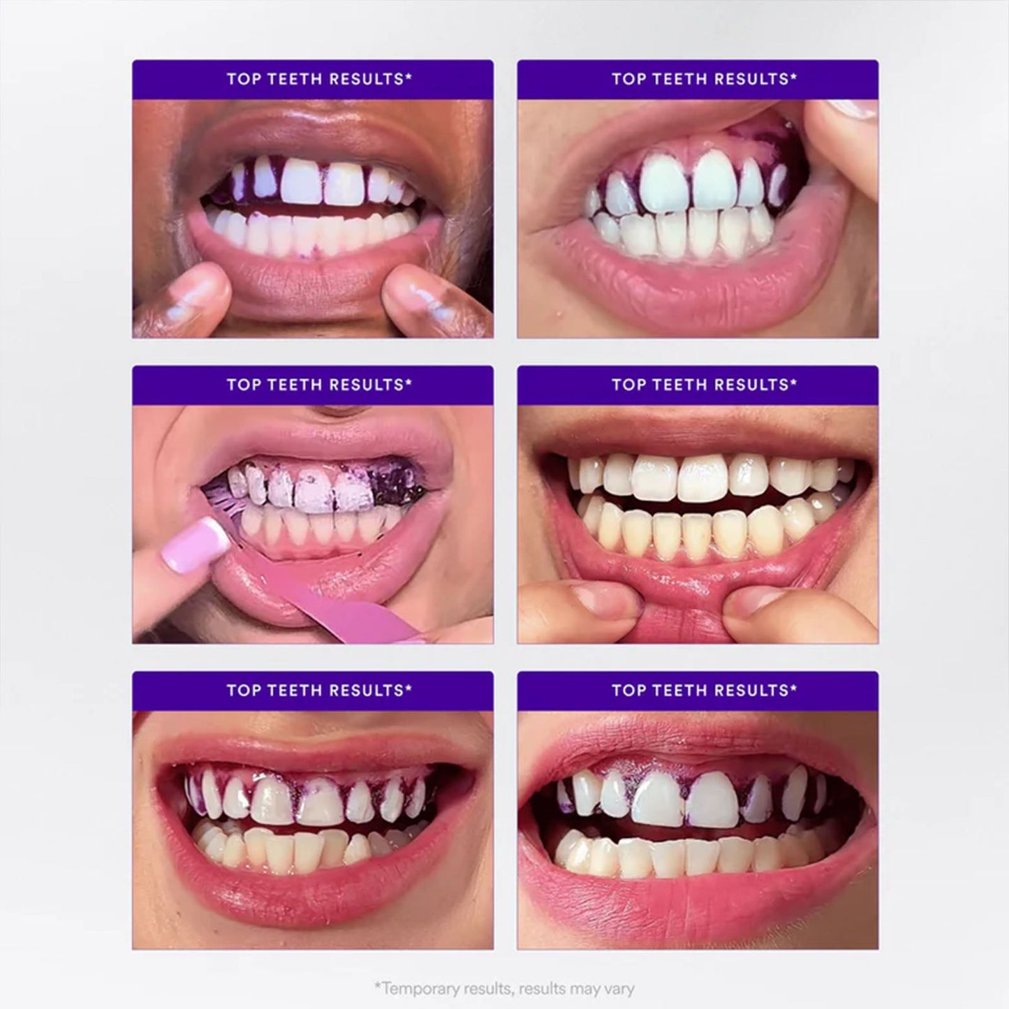 AQA™ Whitening Strips🦷 (🎁Flash Sale - Don’t Miss Out)