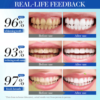 💥Hot Listing 🔥 AQA™ Hydroxyapatite Toothpaste 7.5% for Enamel Repair & Teeth Whitening Refreshing Flavor Fluorid