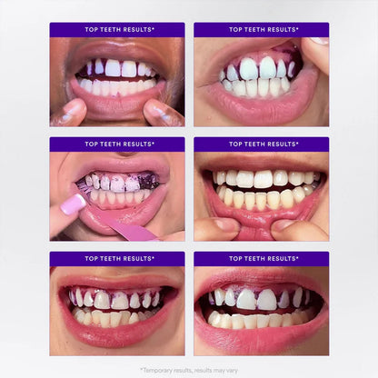 AQA™ Whitening Strips🦷 (🎁Flash Sale - Don’t Miss Out)